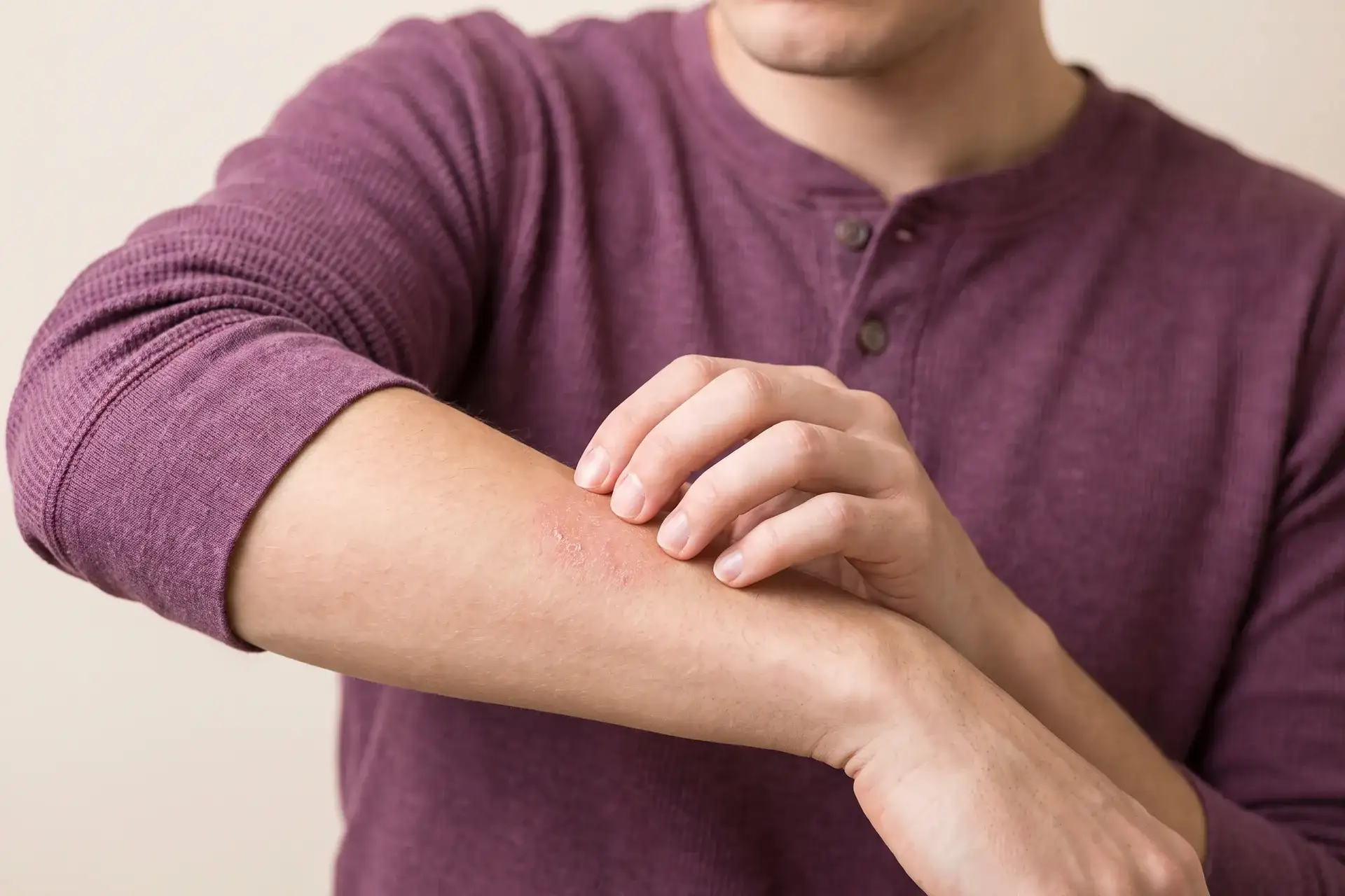 Itchy skin rash on an arm treated by dermatology care in Houston